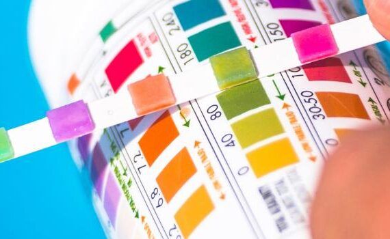 Zu sehen ist das Bild 1 zum Beitrag mit dem Thema: Farbkarte eines Pool-Teststreifen richtig lesen